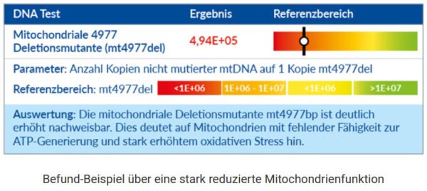 Mitochondrien IHT Oxidativer Stress